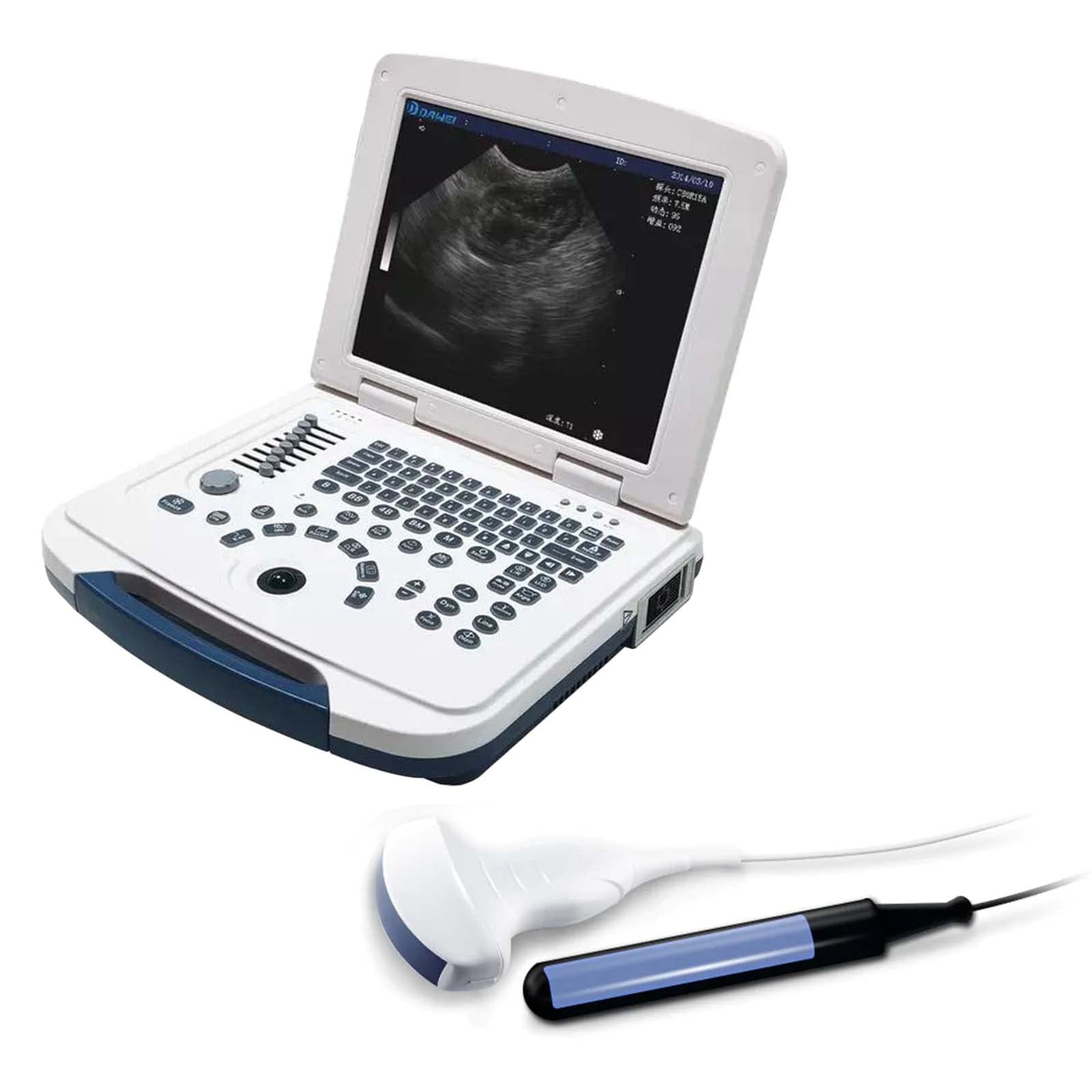 Portable Ultrasound Scanner